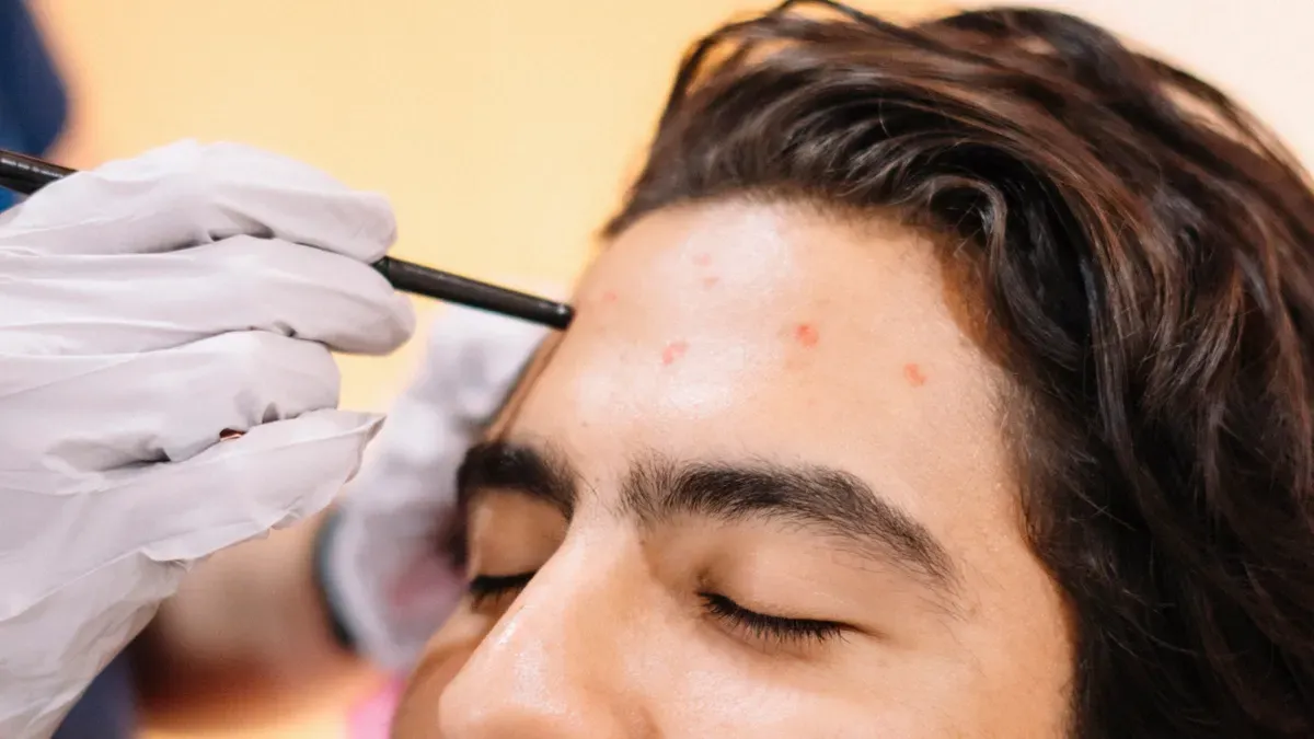 Para que &eacute; usada principalmente uma caneta para transplante capilar?